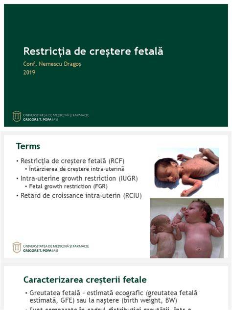 Diagramele de crestere fetala si parametri biometrici feti