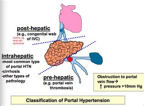 Schema cauzale ale icterului: prehepatic, hepatic, posthepatic