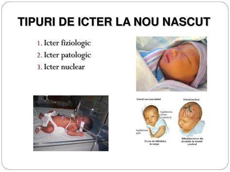 Infographic: Diferențiere icter fiziologic vs. patologic la nou-născut