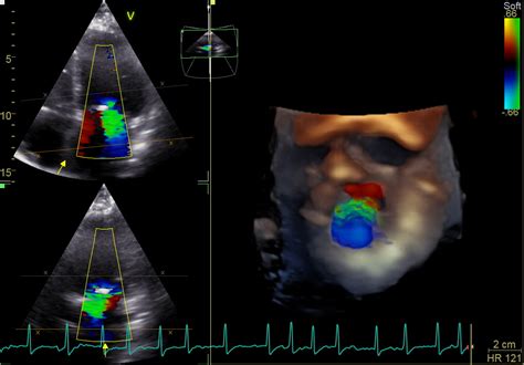 Ecografie 4D cu bebeluș