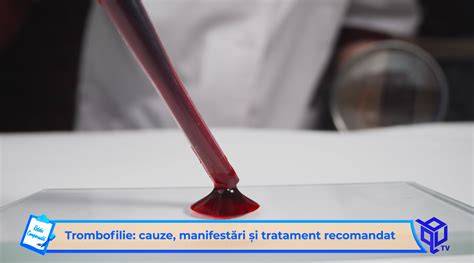 Infografic despre trombofilie: cauze, forme ereditare și dobandite, și principalele manifestări