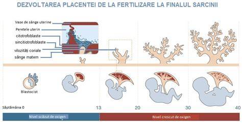 Placenta anterioară: diagramă a poziției placentei în uter
