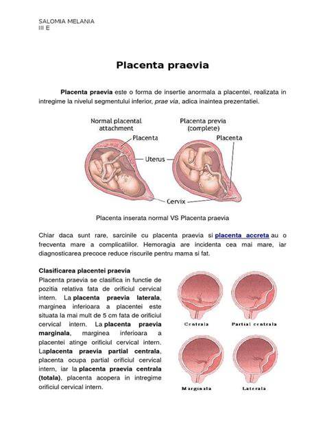 Diagramă: clasificare placentă praevia