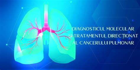 Infografic: Cale de la papilom intraductal la diagnosticul și tratament în timpul sarcinii