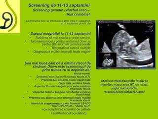 Infografic: Screeningul translucentei nucale si osului nazal in trimestrul I