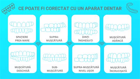 Infografic: tipuri de aparate dentare pentru copii (metal, ceramic, safir)