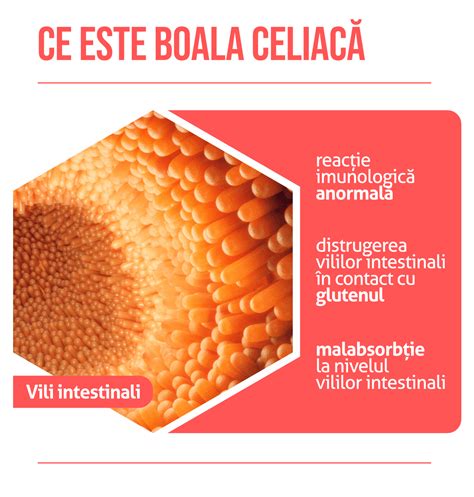 Schema corpului uman cu zonele afectate de boala celiacă și intoleranța la lactoză