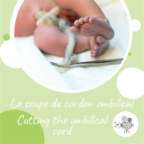 Infografic: etape îngrijire cordon ombilical