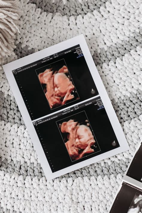 ecografie morfologica trimestrul 3