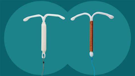 Infografic despre DIU: tipuri, mecanisme de acțiune, perioade de valabilitate