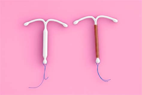 Diagrama compara sterilet cupru vs. sterilet hormonal
