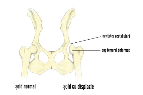 Schemă a displaziei de șold la nou-născut