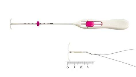 Imaginea unei trasări a structurii Jaydess: forma de T, poziționare intrauterină, fire de extragere