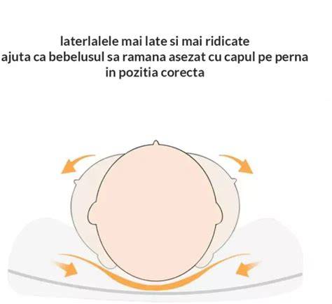 Schematizare a plagiocefaliei si a pozitiei capului la somn
