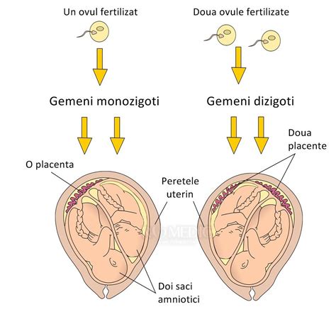 Scheme despre hiperosmie si legatura cu sarcina