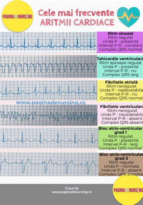 Schema interpretare EKG pediatric