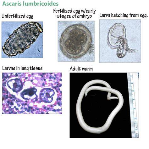 Circulatia larvelor de Ascaris lumbricoides prin plămâni către tractul digestiv