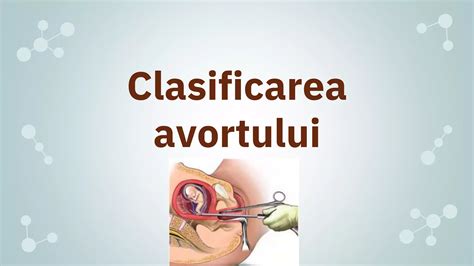 Metode de avort medicamentos și chirurgical