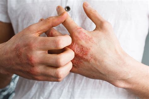 Diagrame despre cum functionează bariera cutanată și impactul emolientelor
