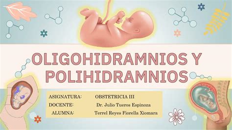 Diagramă: mecanismele oligohidramnios si polihidramnios