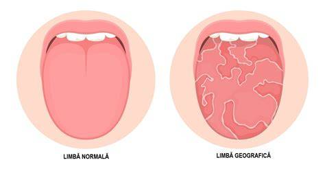 Diagram: Flux diagnostic limba geografica