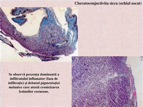 Aspect folicular al conjunctivei