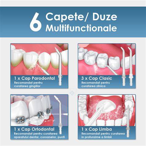 Infografic: Alegerea unui irigator bucal potrivit pentru sarcină (factori cheie: tip, presiune, capete, rezervor)