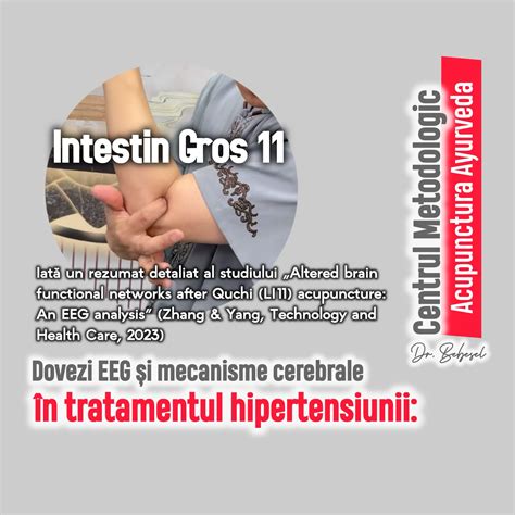 Infografic: fluxul sangvin și mecanismele edemului gestational