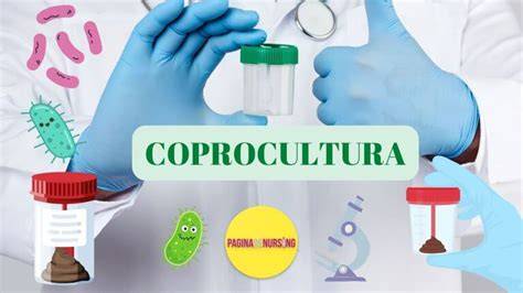 Infografic: Pasii recolectarii probei de fecale pentru coprocultura