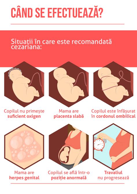 Infografic despre riscurile operației de cezariană