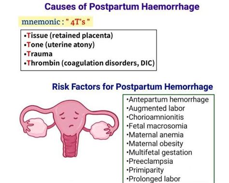 Infografic: Schema celor 4 Ts ale hemoragiei postpartum și fluxul de intervenții