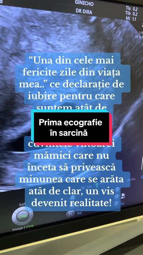 Diagramă a claselor de sarcină în obstetrică