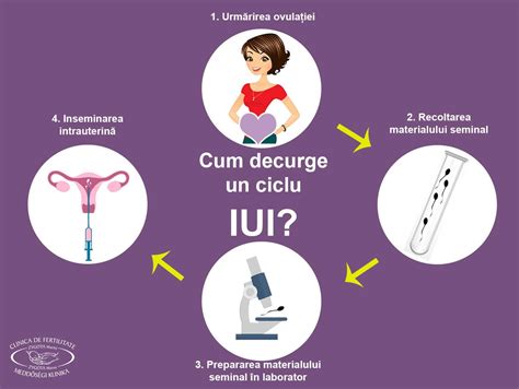 Diagramă a etapei de inseminare IUI prin cateter