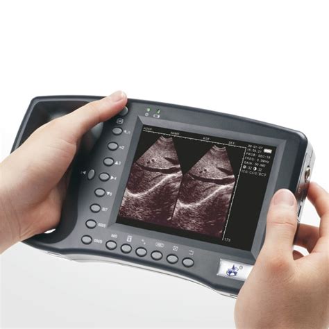 Imagine cu ecograf ginecologic