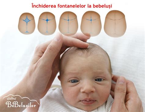 Forma și localizarea fontanelei anterioare